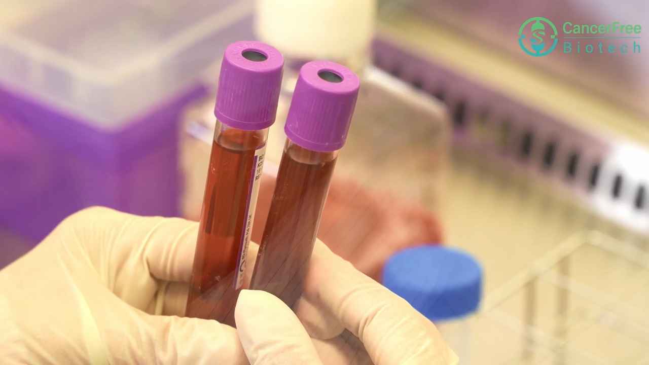 CancerFree Biotechのラボ内で紫色の採血管（血液検体）を持つ手袋を着用した研究員の手元
